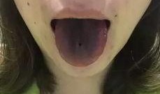 吃瓜舌头会变黑吗视频