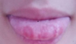 吃瓜舌头会变黑吗视频